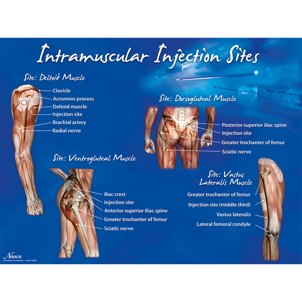 Плакат с обозначением мест внутримышечных инъекций