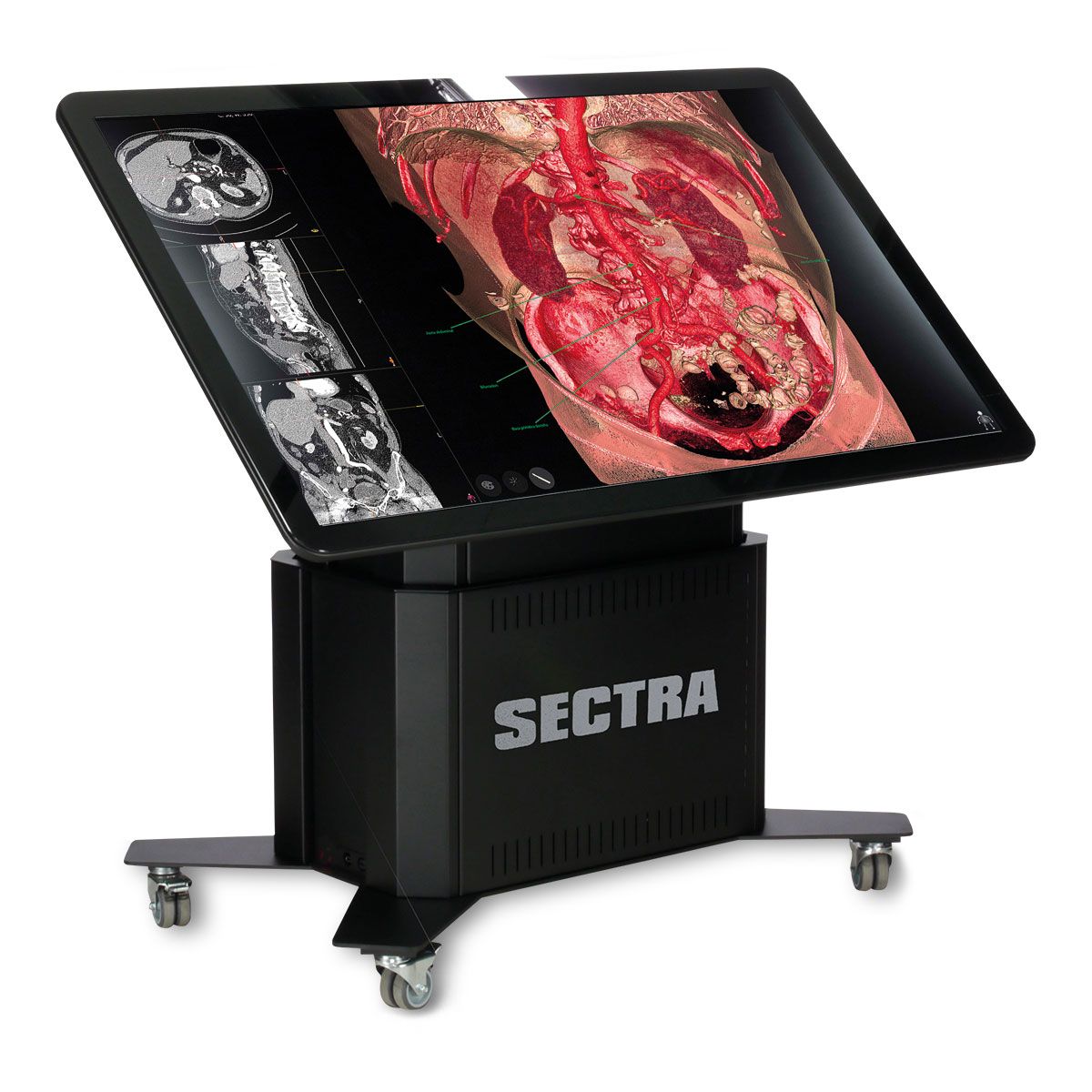 SECTRA виртуальный стол для анатомирования - Образовательный портал сроком на 1 год